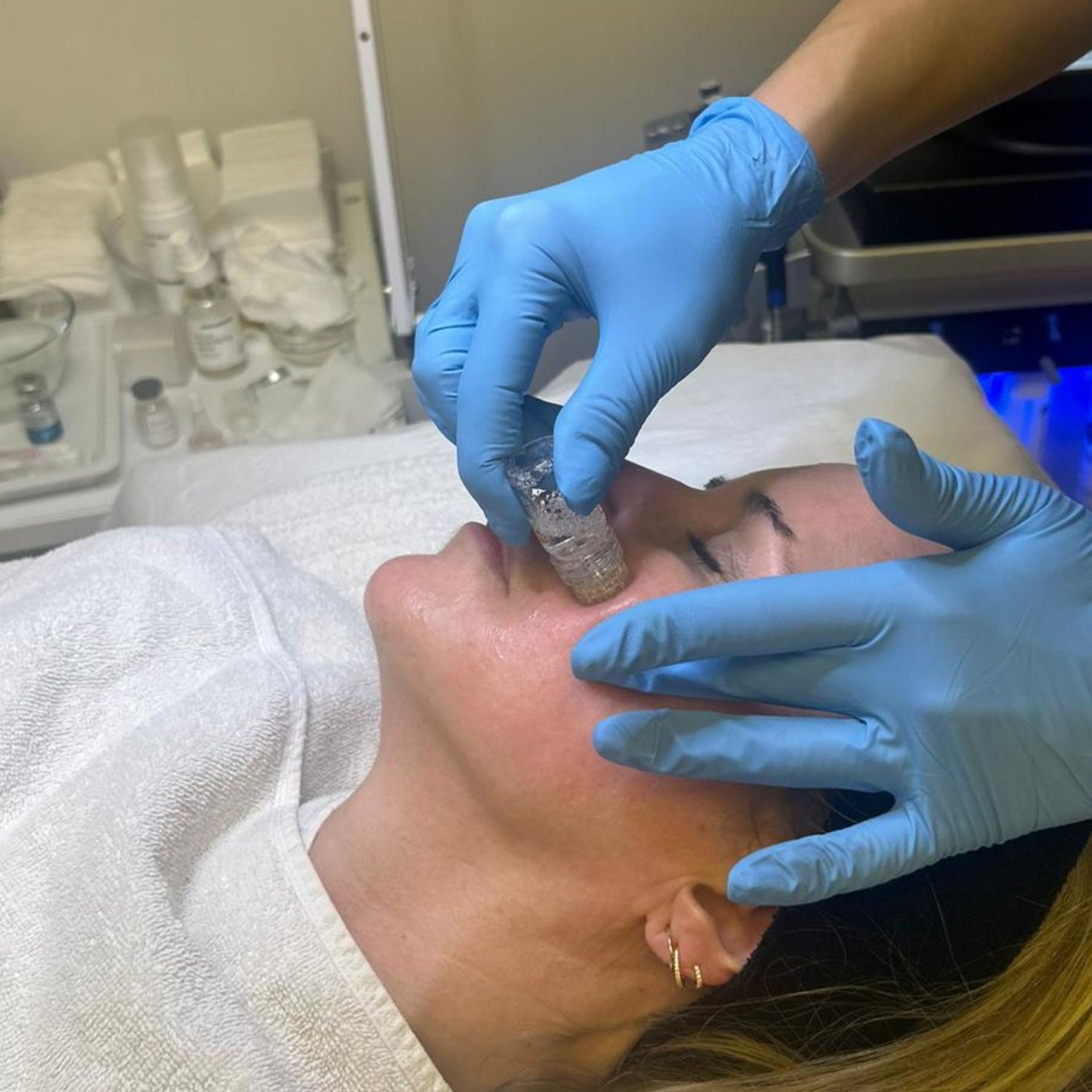 Aquagold Fine Touch Facial, a type of mesotherapy that uses a cocktail of dilute Botox®, hyaluronic acid and PRP for a mega glow, at Medicetics London
