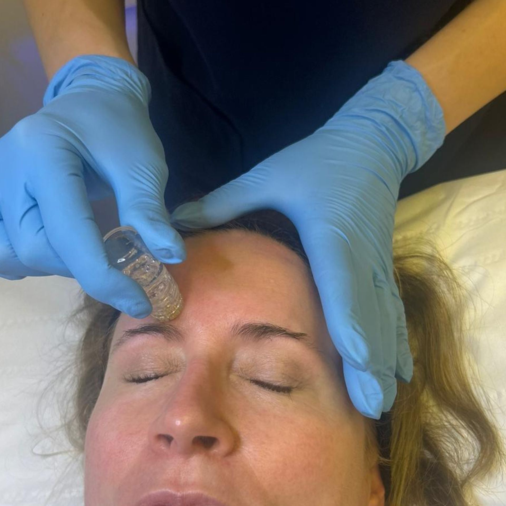 Aquagold Fine Touch Facial, also known as the ‘Gold Microinfusion facial’ or the ‘Glass Skin Facial’, at Medicetics London