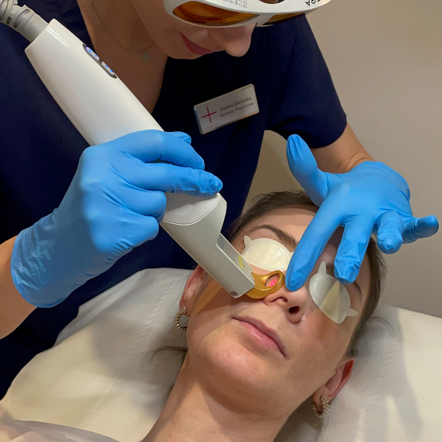 Excel V Treatment to target redness and pigmentation at Medicetics