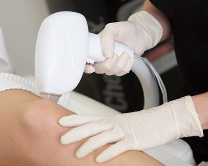 Laser Hair Removal Questions, Answered