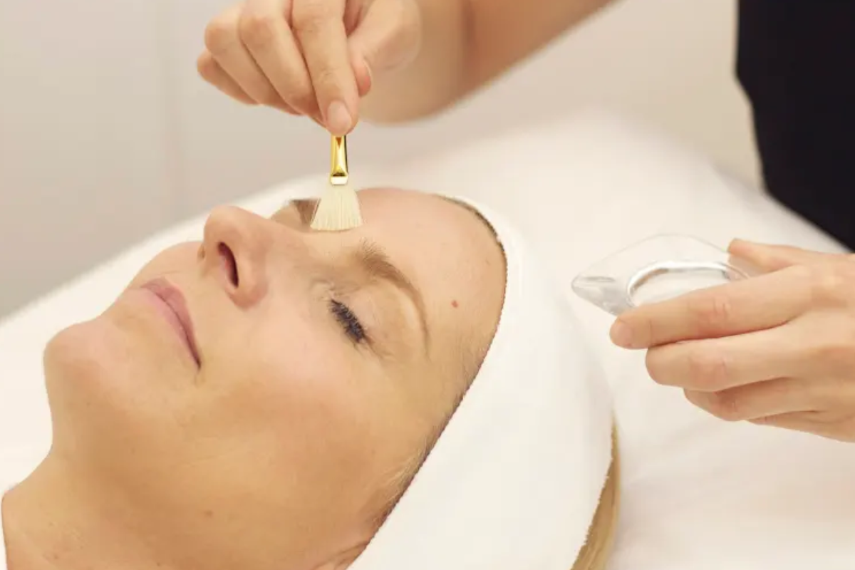 Benefits of Skin Peels with Dr Vicky Dondos of Medicetics