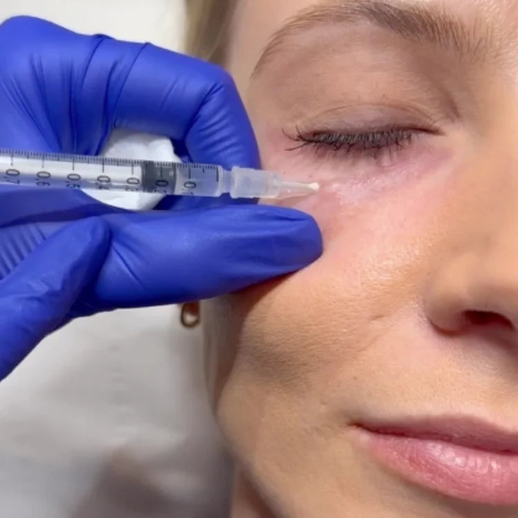 Polynuclear Eye Injection Polynucleotide Under Eye Treatment: Brighten Your Eyes with this ...