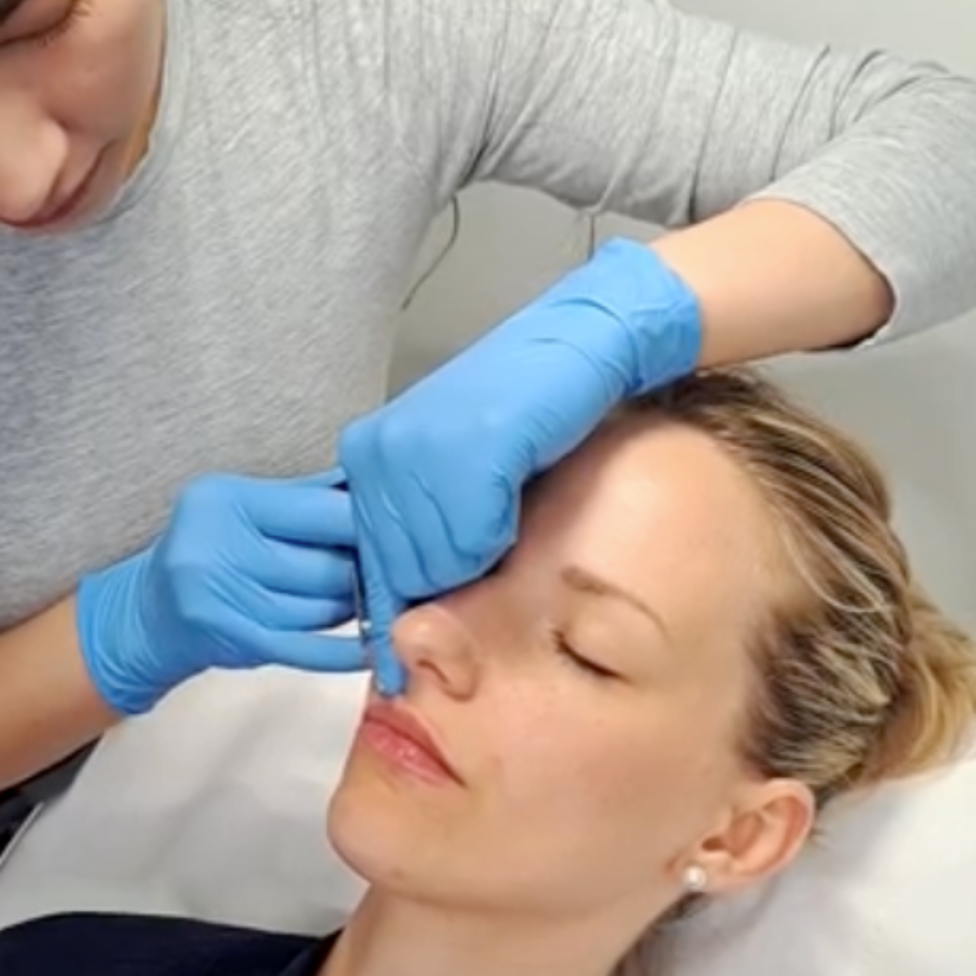 dr Vy injects hyaluronic acid lip fillers into a clients lips for a fuller lip at Medicetics, London.