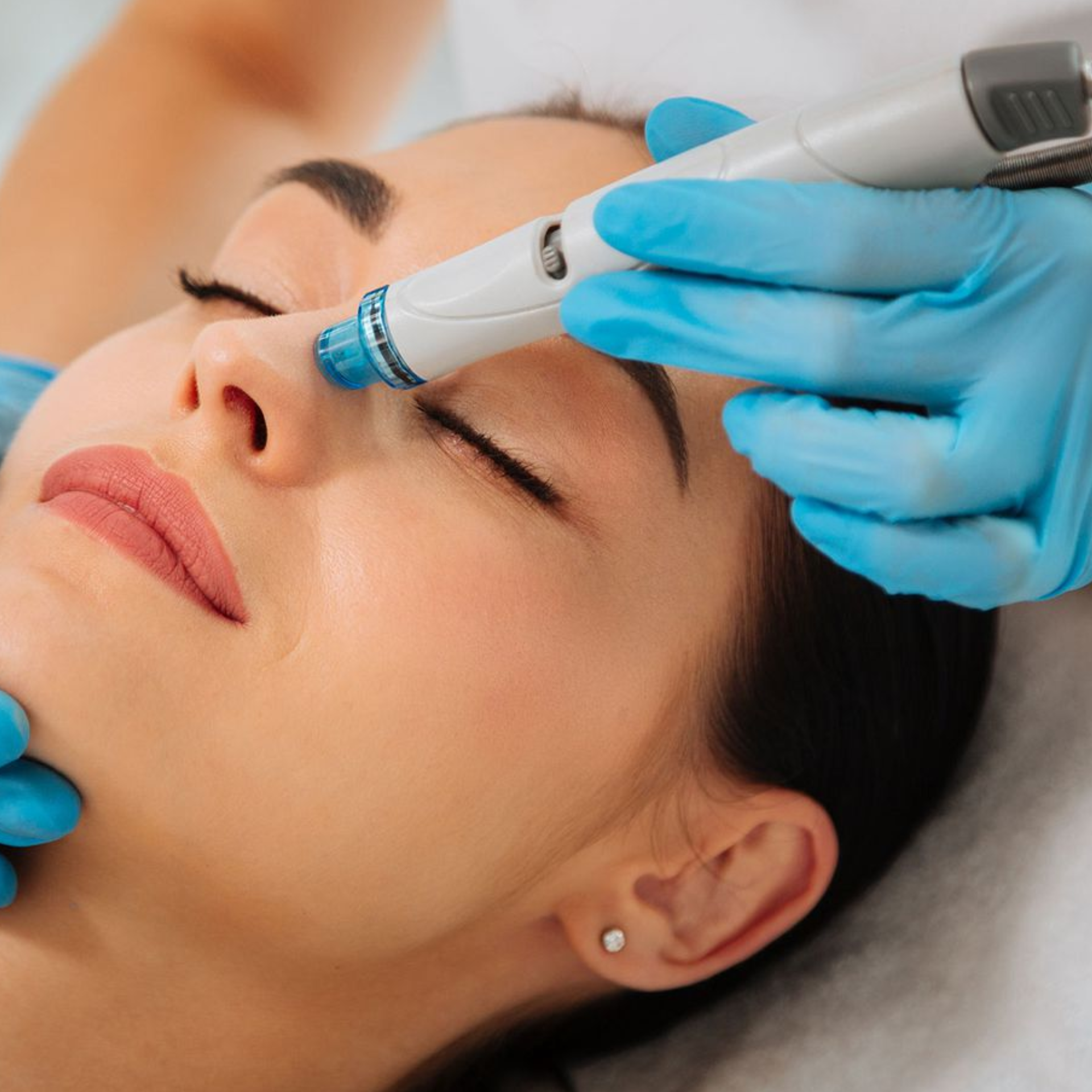 Hydrafacials, an advanced facial treatment, in London