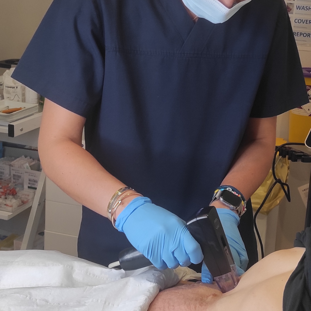 Dr Sepi treats a patient with Morpheus 8 Body to tighten sagging skin on their belly. Treatment is at Medicetics, Central London.