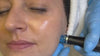 Video of a Medicetics client having a hydrafacial treatment.